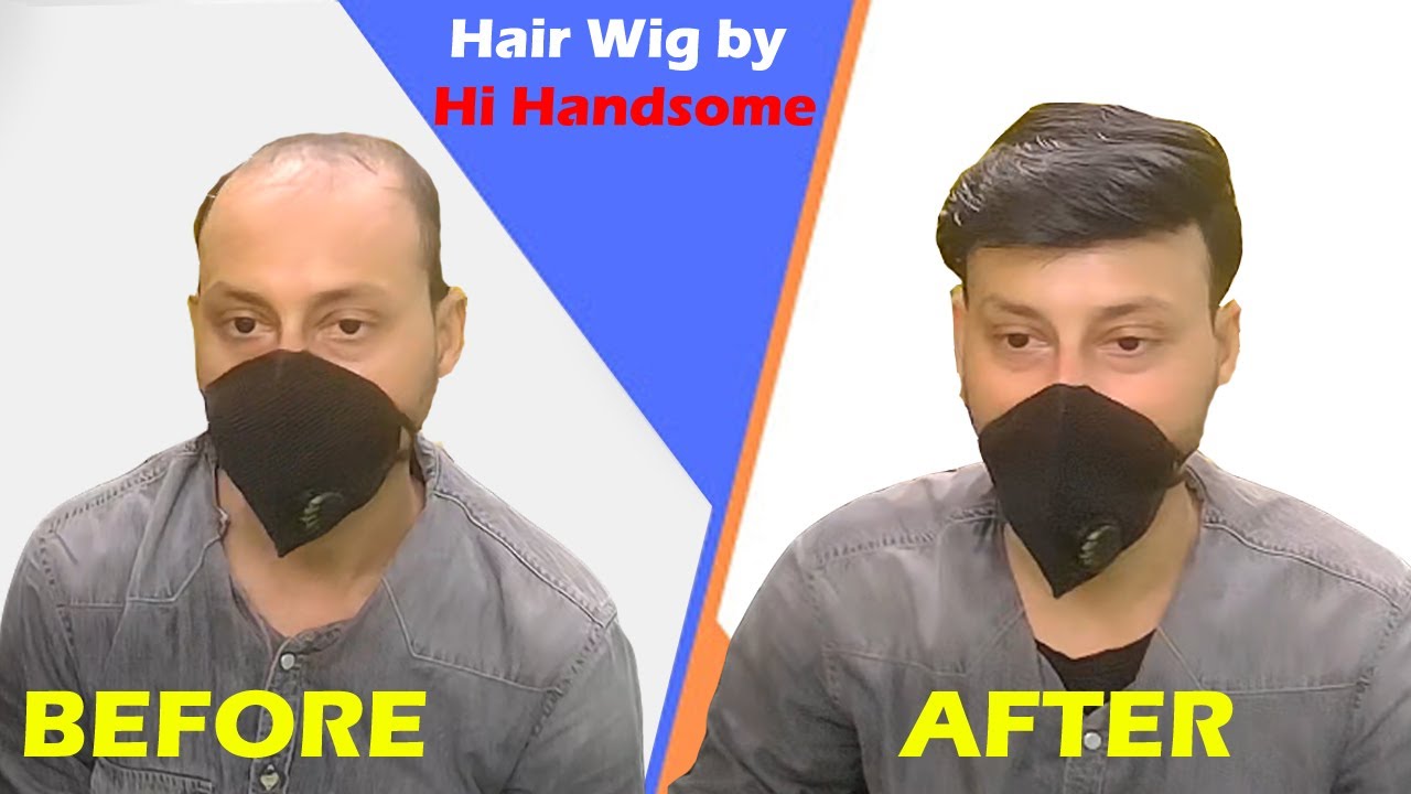 How to look Hair Wig | Ultra Hold Glue Power for Hair patch and Hair Wig by - Hi Handsome