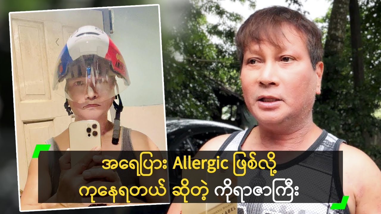 အရေပြား Allergic ဖြစ်လို့ ကုနေရတယ် ဆိုတဲ့ ကိုရာဇာကြီး