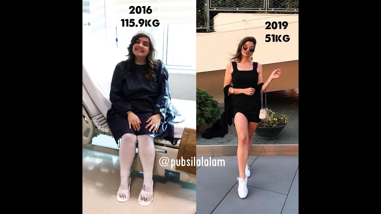 Tüp Mide Ameliyatımın İlk 3 Günü Nasıldı ? Hastane Sürecinde Neler Yaşadım ?