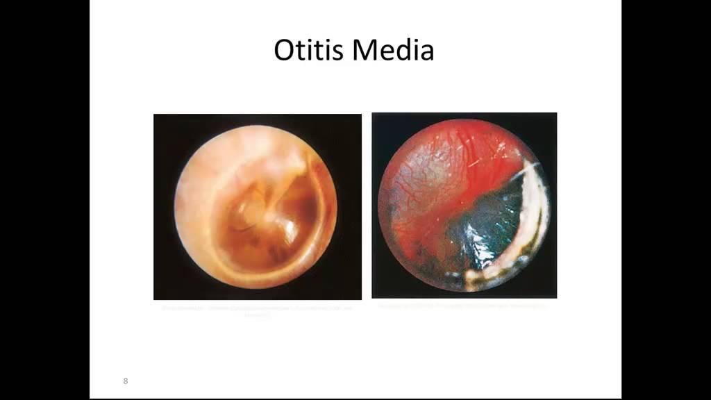 Pediatric Diseases