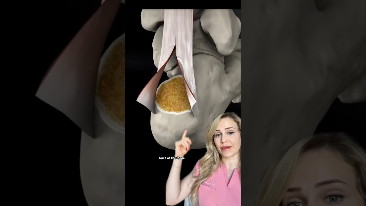 Doctor explains Achilles surgery