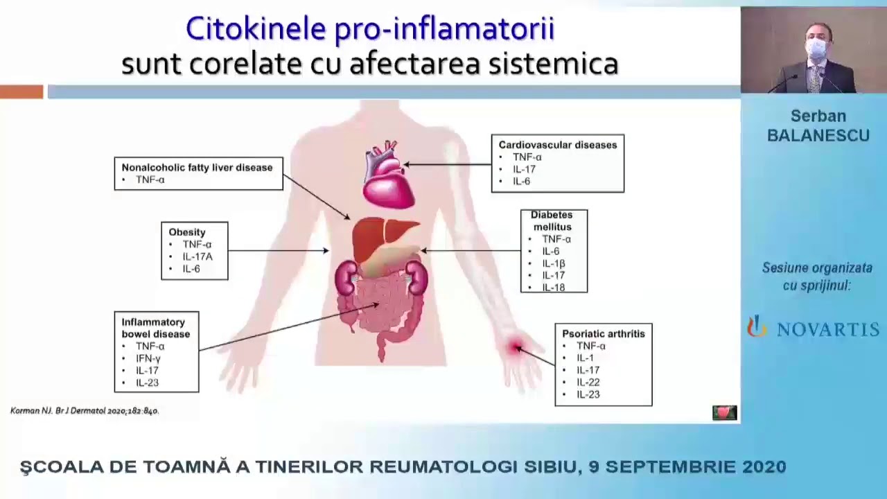 Artropatia psoriazica si boala cardio-vasculara: 