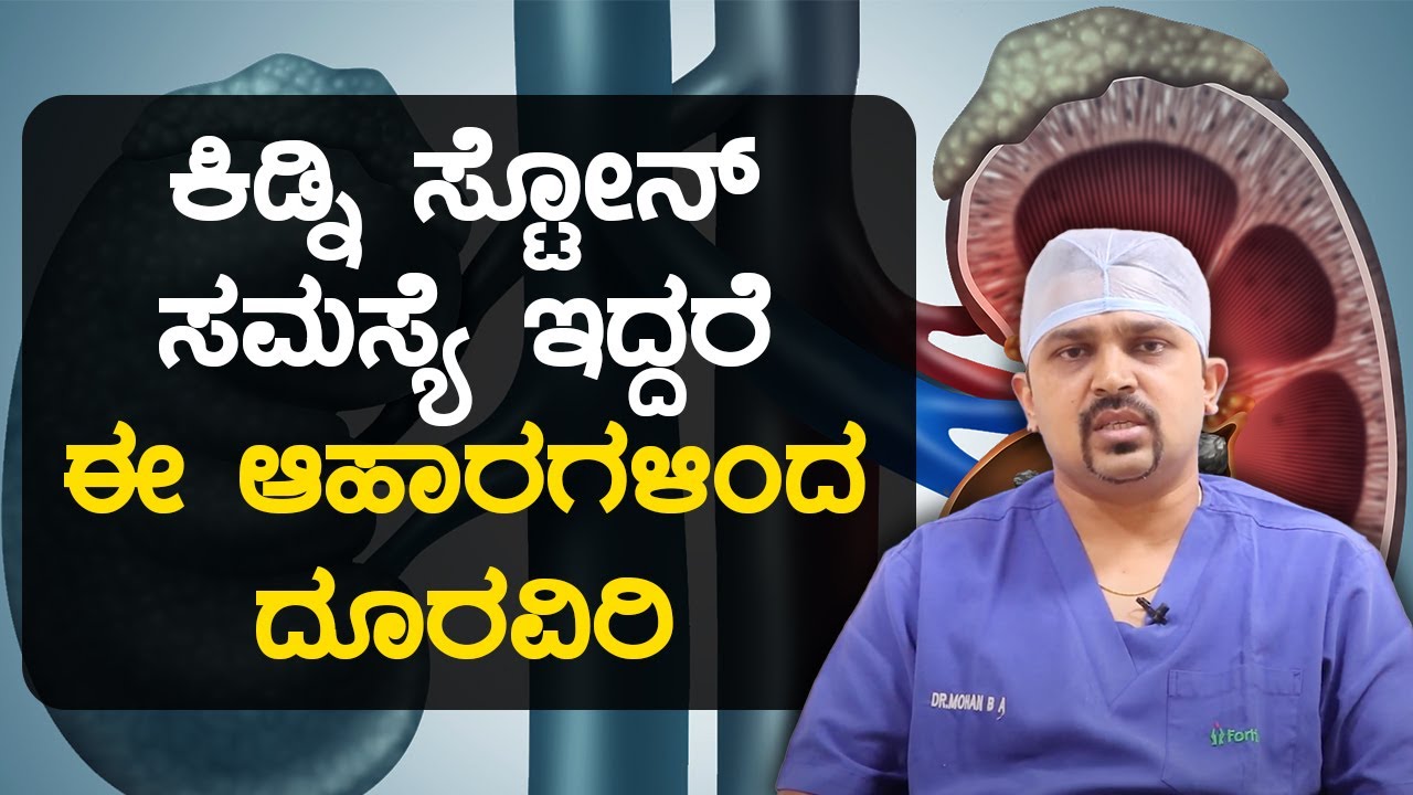 ನಿಮಗೆ ಕಿಡ್ನಿ ಸ್ಟೋನ್ ಇದೆ ಎಂದು ತಿಳಿಯುವುದು ಹೇಗೆ? | Kidney Stone Diet: Foods to Eat and Avoid