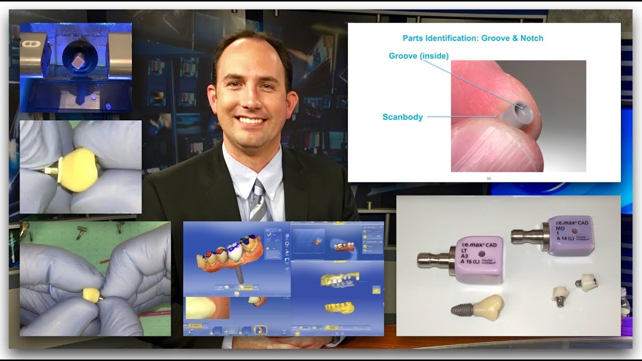 CEREC TiBase How-To #1 (new and improved...and with inspirational music!)