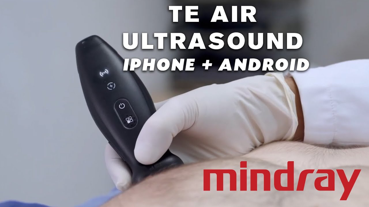 Portable Ultrasound Revolution: Mindray TE Air i3P for iPhone & Android