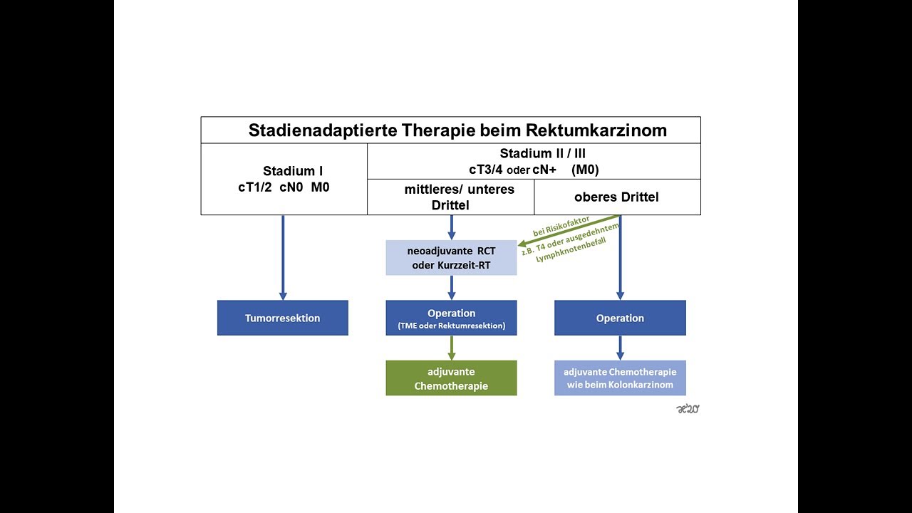 Stadienadaptierte Therapie beim Rektumkarzinom  | Strahlentherapie Prof. Hilke Vorwerk