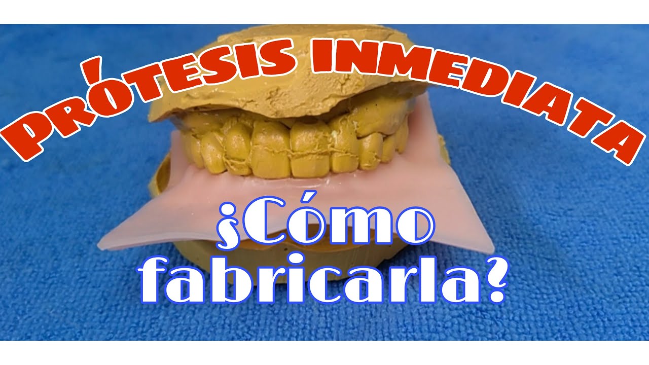 Prótesis Dental total inmediata