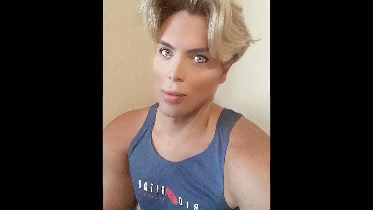 Seis anos após a minha cirurgia de mudança de cor dos olhos - BrightOcular