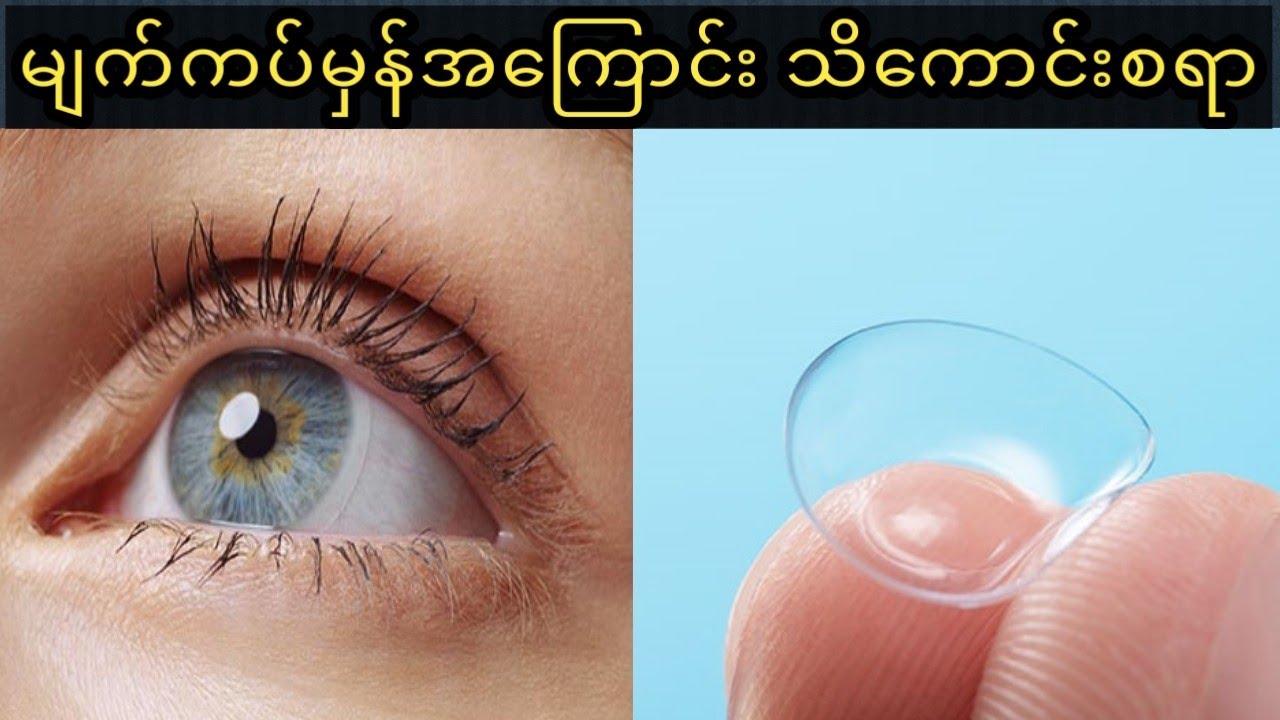 မျက်ကပ်မှန်တပ်တော့မယ်ဆိုဘာတွေသိထားသင့်လဲ