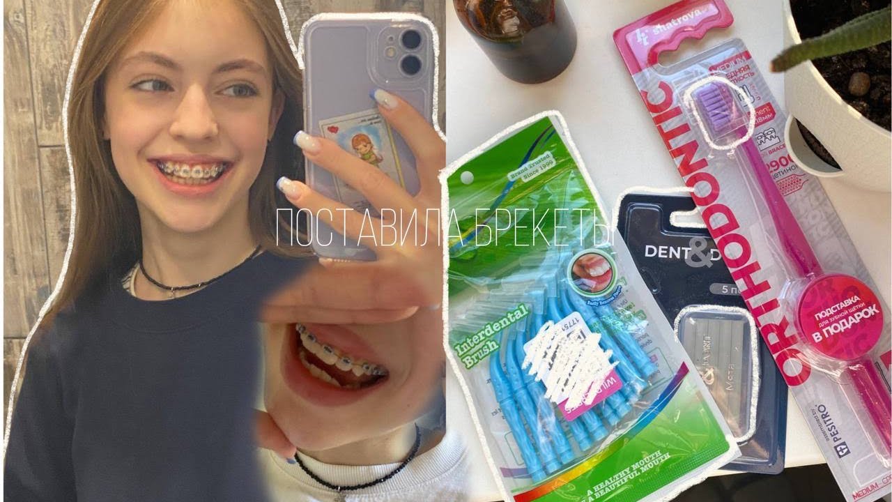тихий влог🤍 : ставлю брекеты🦷/первые ощущения и дни/что я кушала?