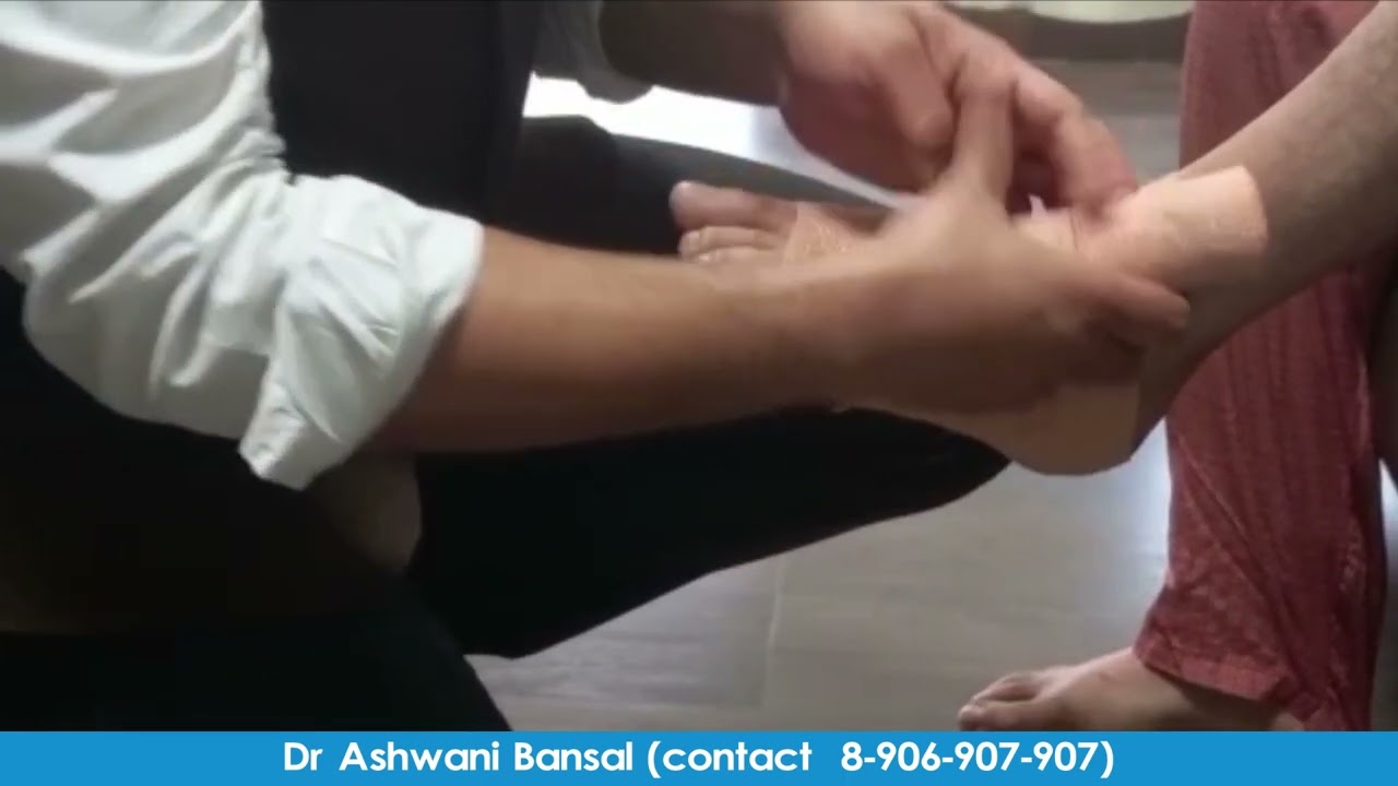 Crepe bandage instruction for patients after bypass heart surgery | Abheartcare | Dr Ashwani Bansal