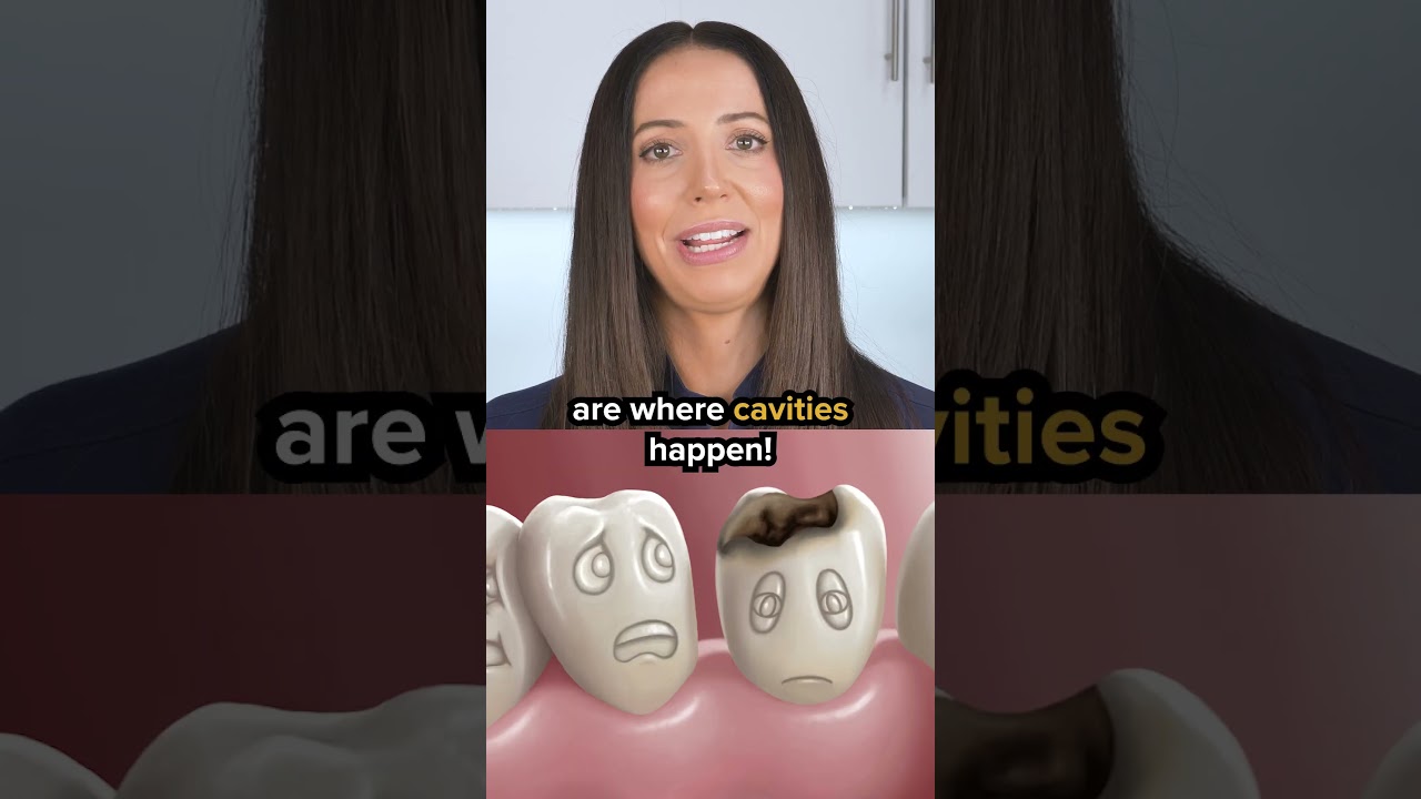 non-fluoride toothpaste (nano-hydroxyapatite toothpaste) explained #shorts