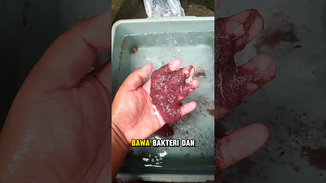 Jangan sampai salah perawatan..! 