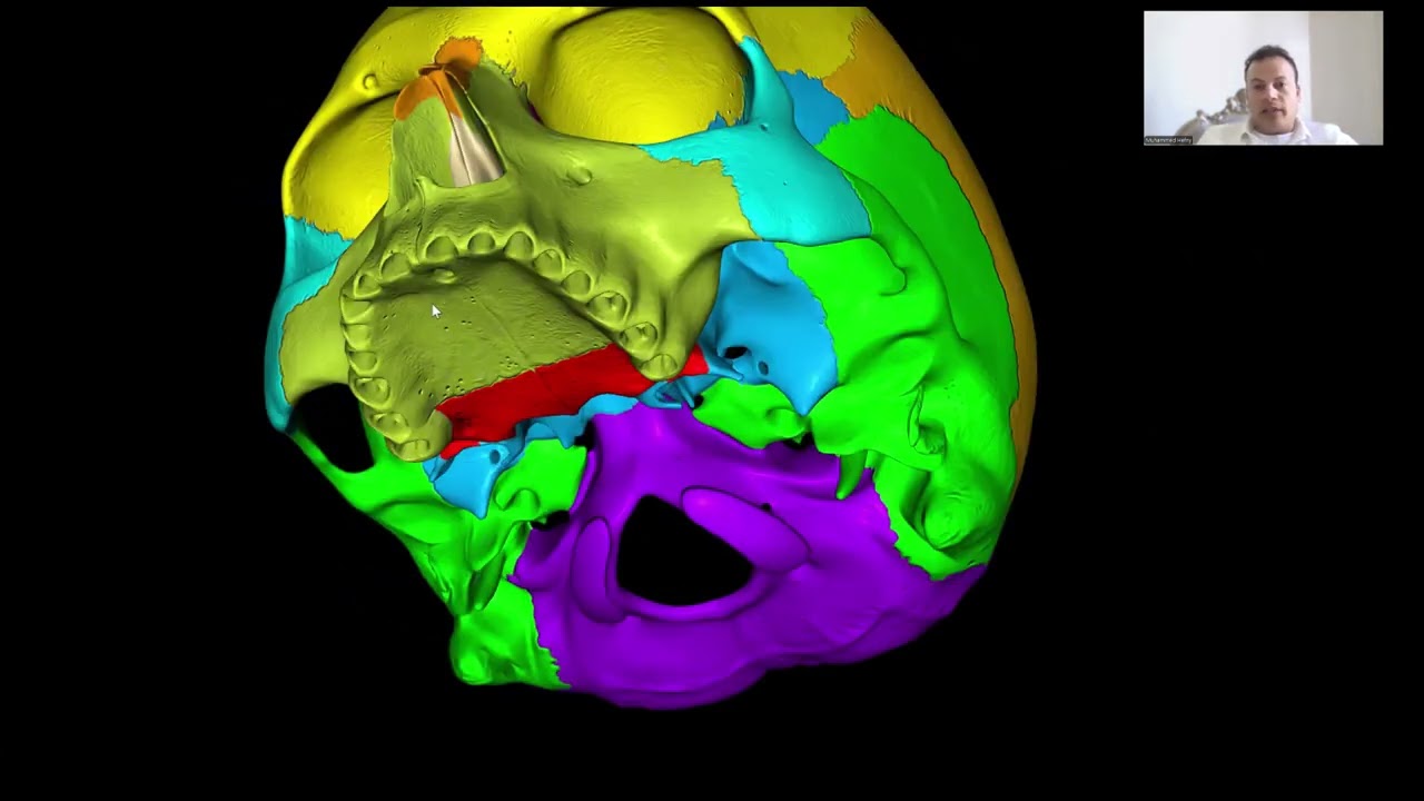 avc norma frontalis