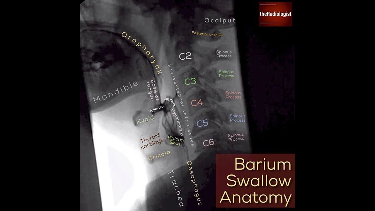 Barium Swallow and Modified Barium Swallow (Cine)