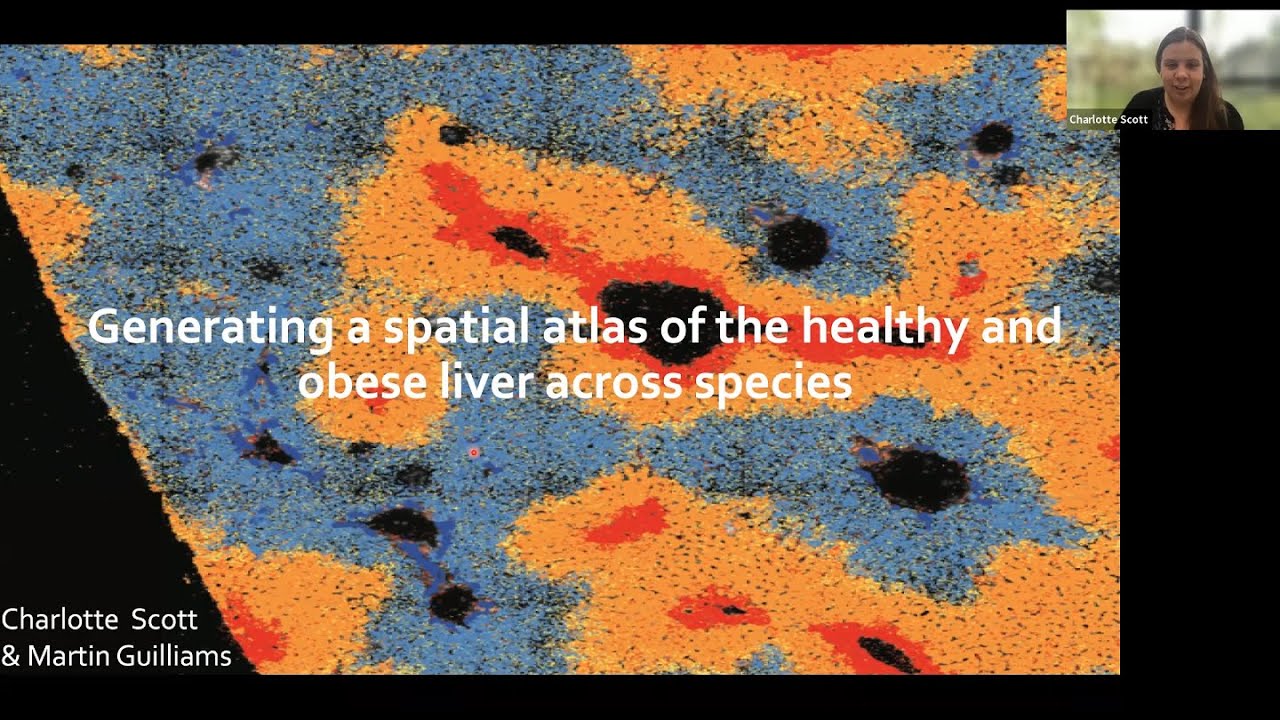 Generating a spatial atlas of the healthy and obese liver across species