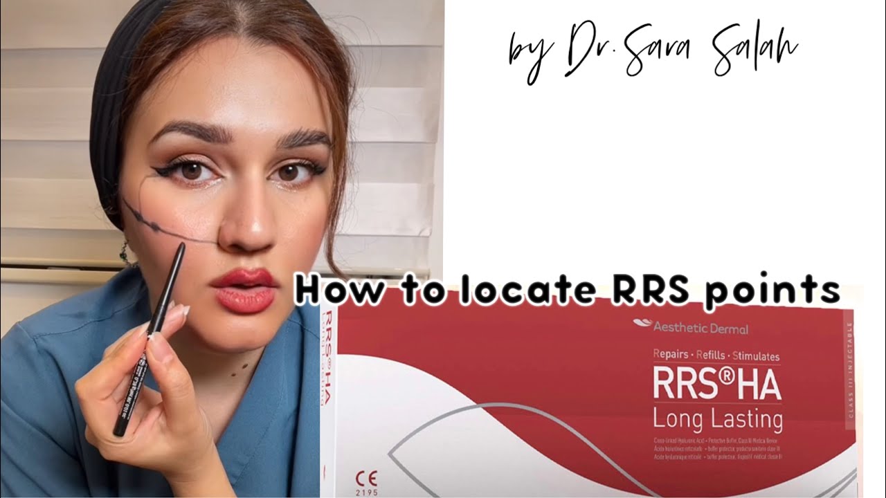 RRS points and how to locate them