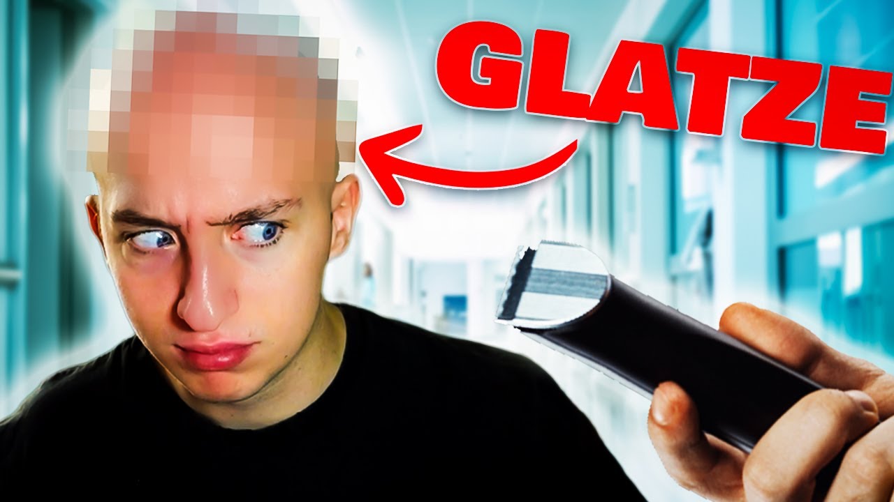Ich habe keine HAARE mehr... (Haartransplantation)