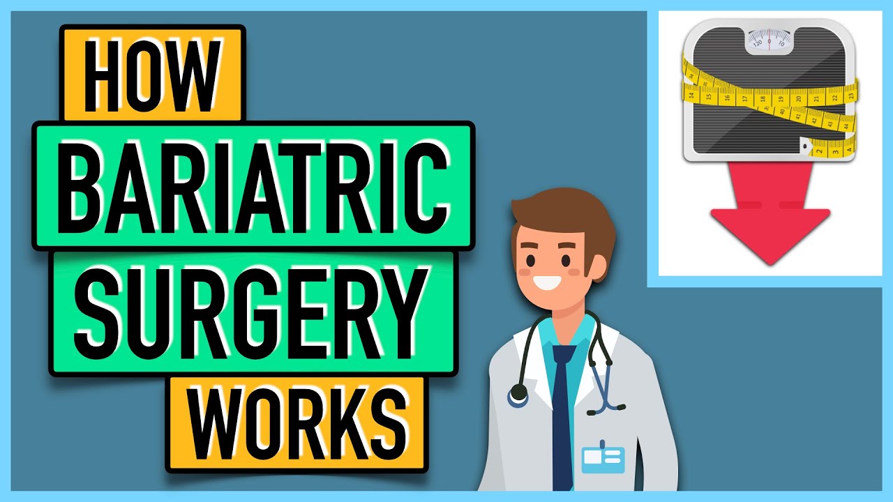 How Bariatric Surgery Works