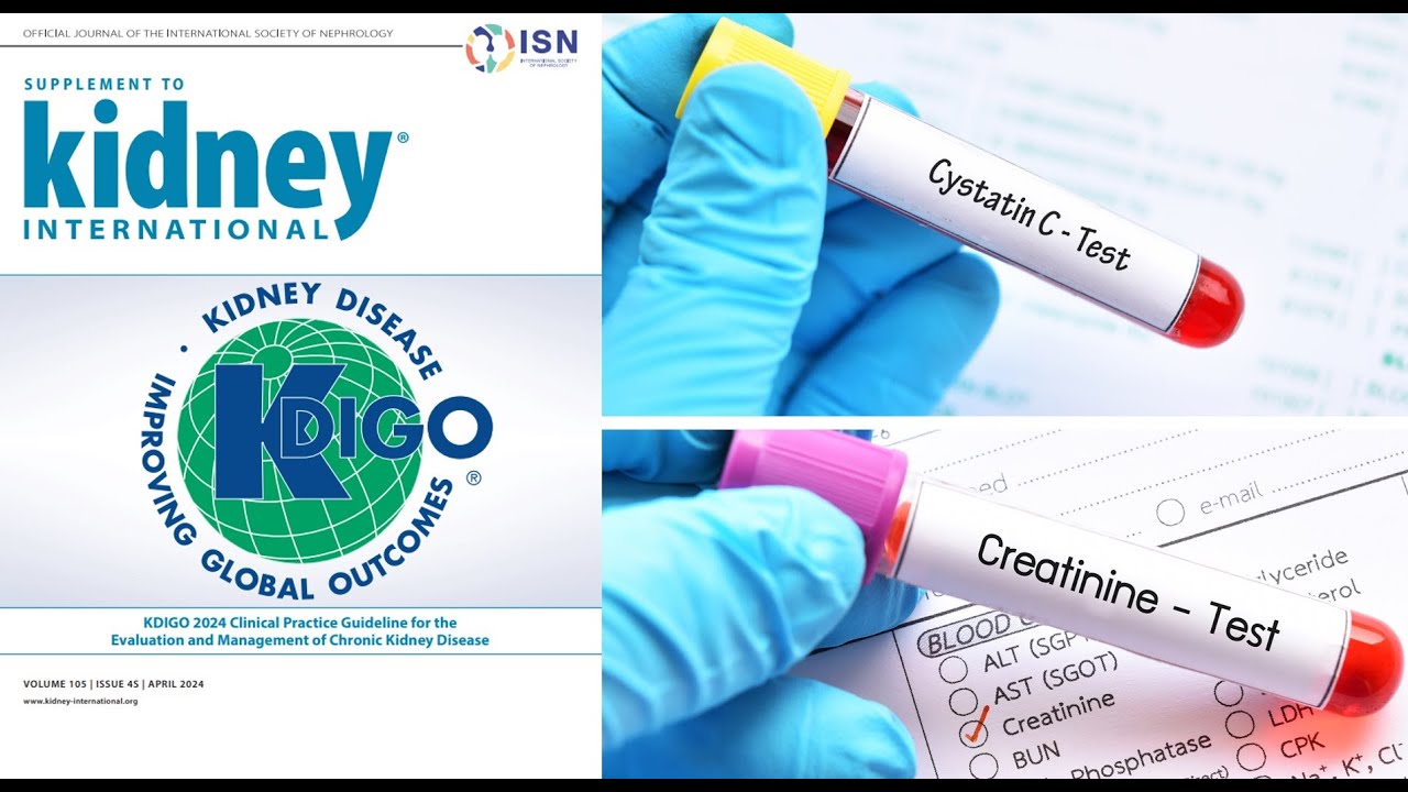 Nuevas recomendaciones para diagnóstico de la enfermedad renal crónica - KDIGO 2024. Luis Figueroa