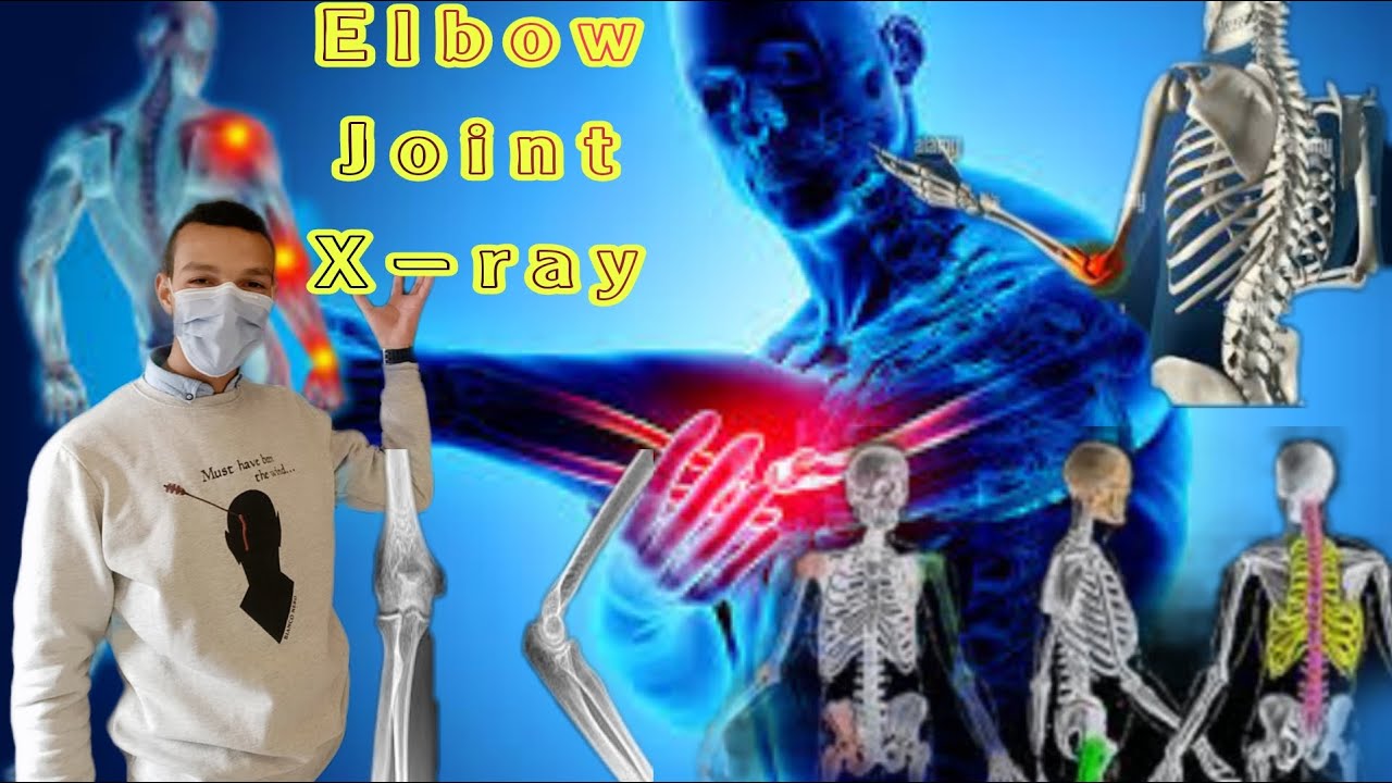 Elbow joint x-ray (position -anatomy). الأشعة العادية لمفصل الكوع الأوضاع -التشريح#الأشعة