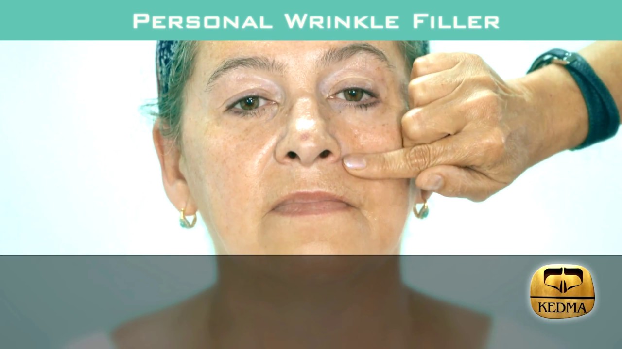 KEDMA Personal Wrinkle Filler in Action