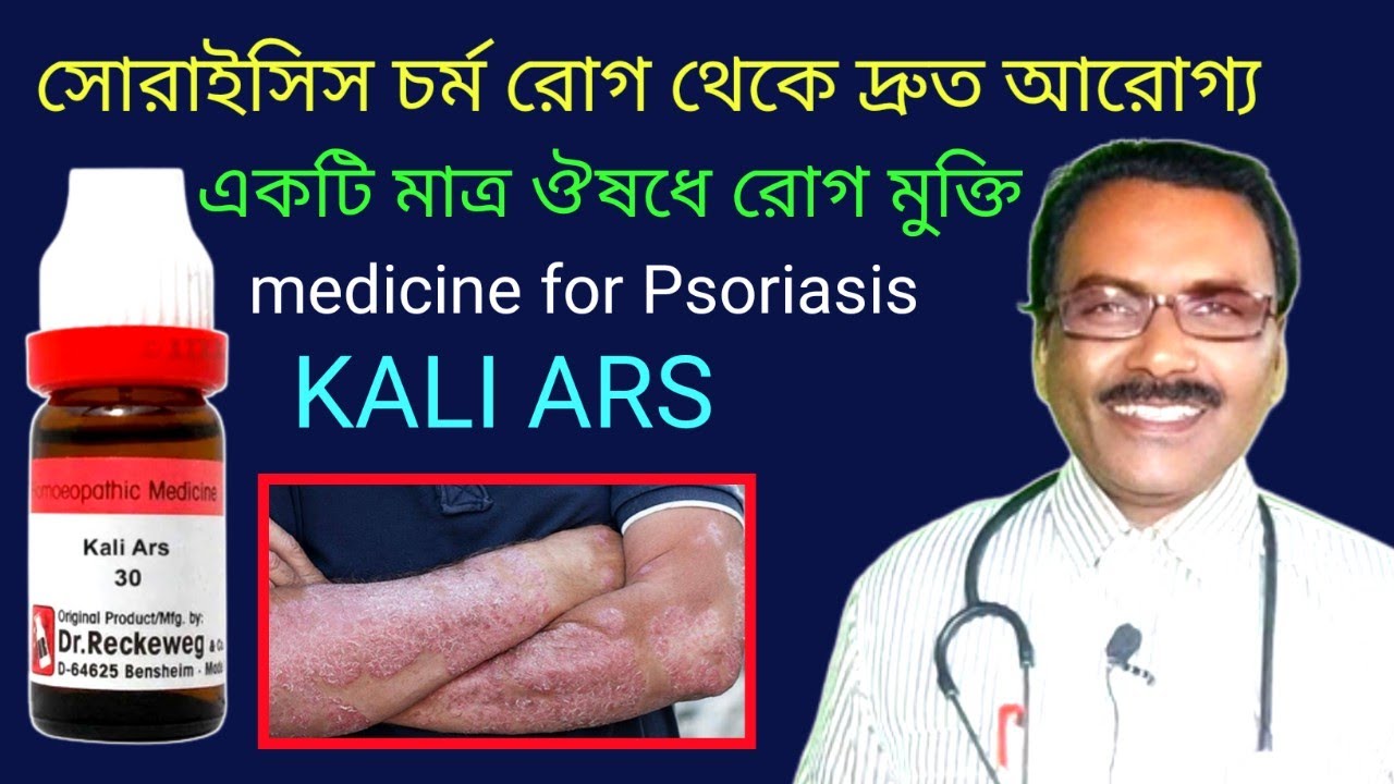 Medicine for Psoriasis || সোরাইসিস চর্ম রোগ থেকে দ্রুত মুক্তি || Dr SP Goswami