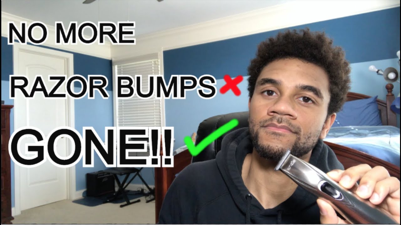 HOW TO PREVENT RAZOR BUMPS - Treat Razor Bumps & Ingrown Hairs