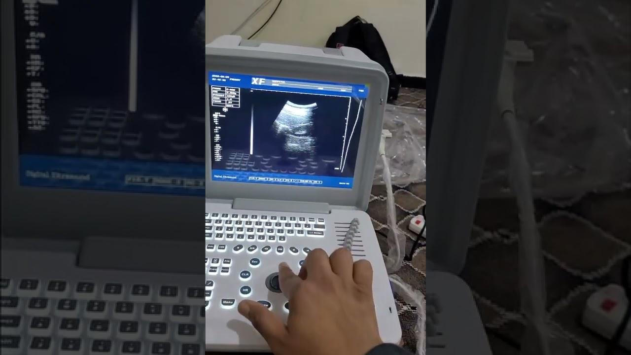 شرح طريقة العمل علئ جهاز #سونار_XF300وكيفية اخذ القياسات ومعرفة شهر الولادة المتوقع وتاريخ الولادة