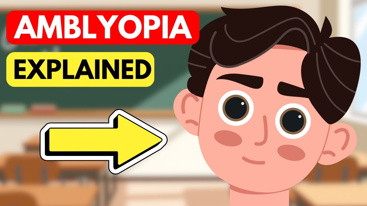 What is LAZY EYE (Amblyopia)?