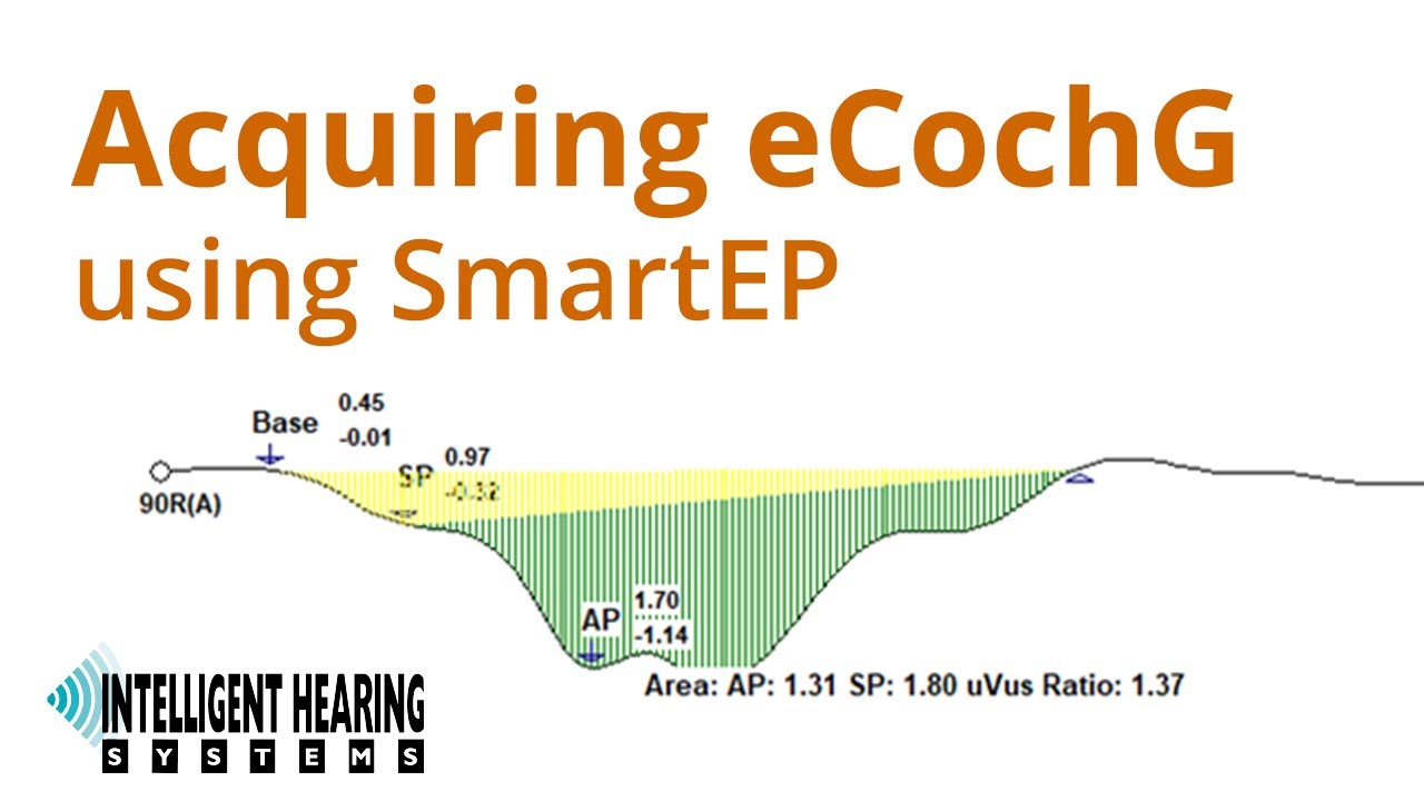 IHS Training Session: Acquiring eCochG Responses using SmartEP