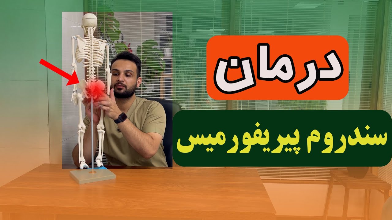 درمان سندروم پیریفورمیس