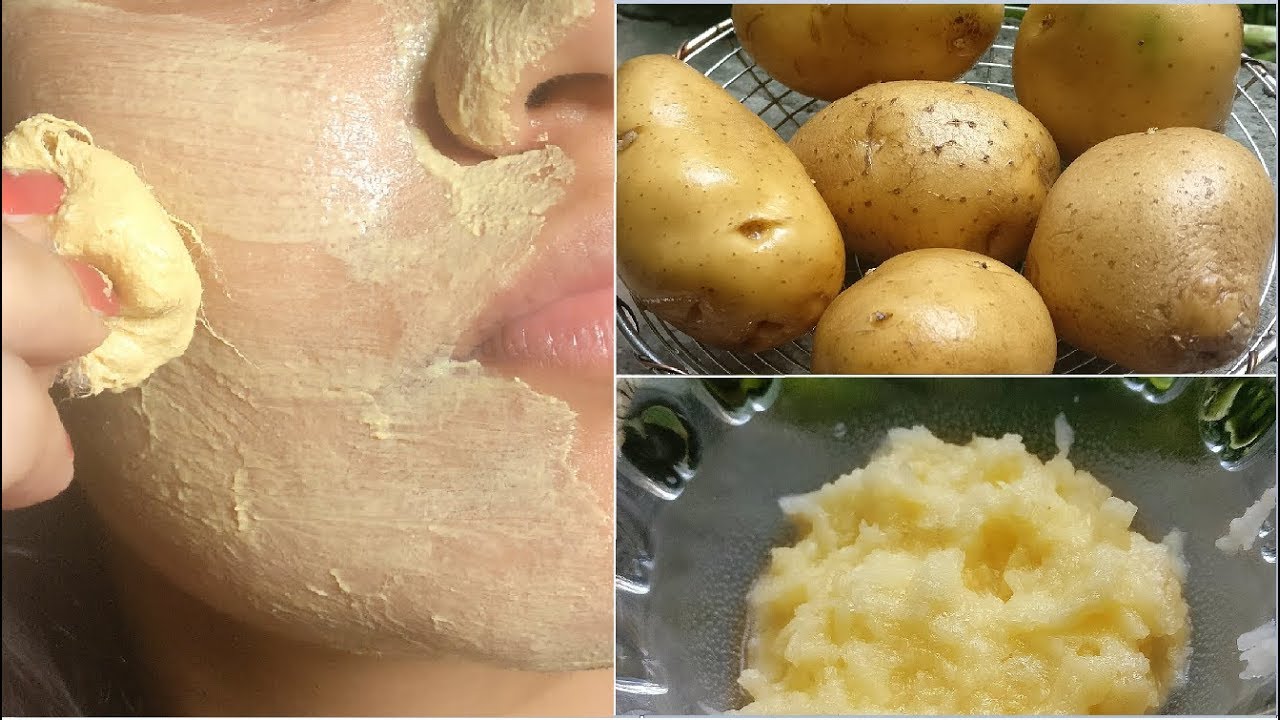 it removed my Dark Spots in 30 Days Potato Facial Mask for Hyper pigmentation,Skin Whitening,Pimples