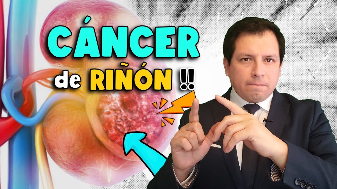 IMPORTANTE ⚠️  SÍNTOMAS DEL CÁNCER DE RIÑON A TOMAR EN CUENTA !!