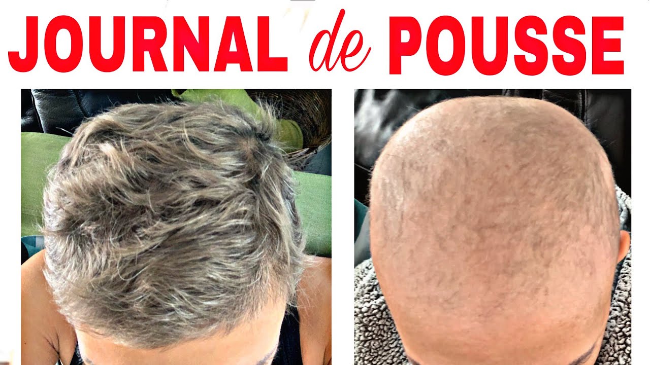 POUSSE DE CHEVEUX + CILS IMPRESSIONNANT (JOURNAL DE POUSE)  comment faire pousser ses cheveux