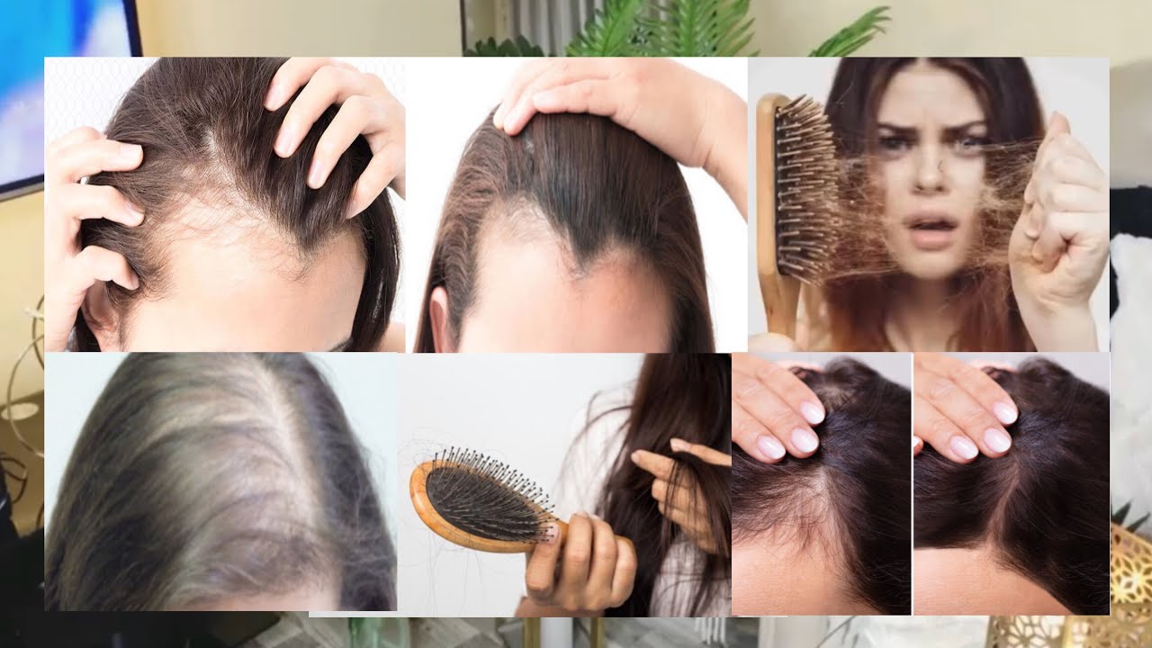 Challenge Timaha Part 8 Timaha Wajiga hore gadal u ga siktay sida lo so celiyo io sababta kento