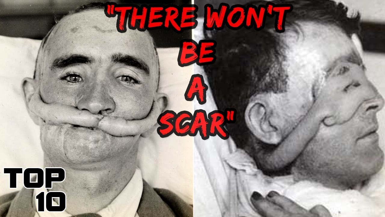 Top 10 Messed Up Treatments Doctors Lied About