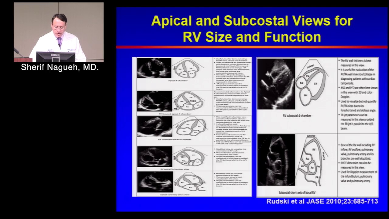 Assessment of RV Function (Sherif Nagueh, MD) February 14, 2017