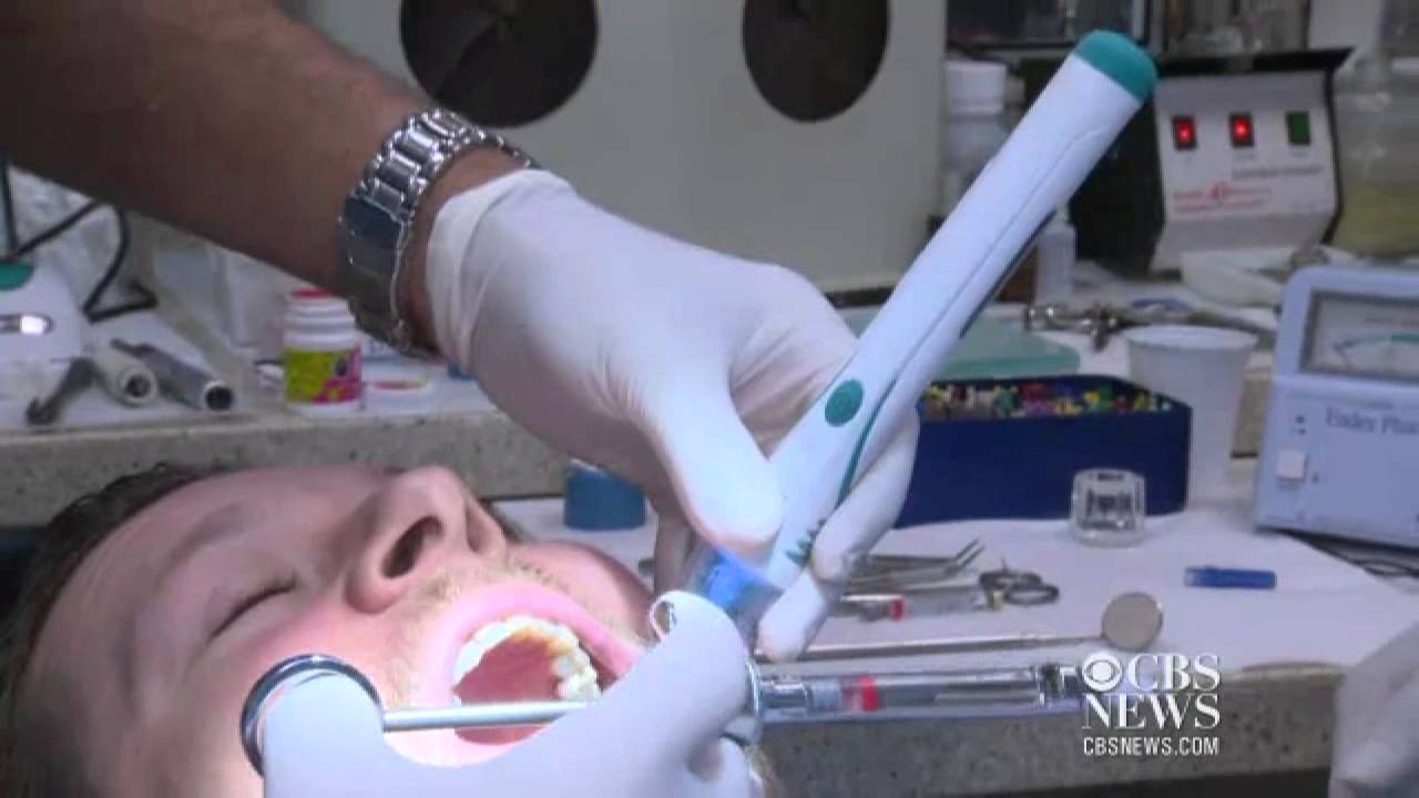 DentalVibe takes the pain out of root canals