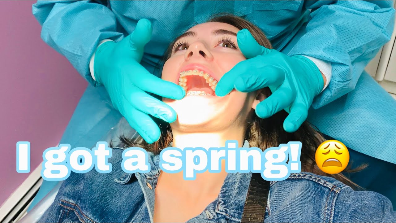 PAINFUL second braces appointment update!!!