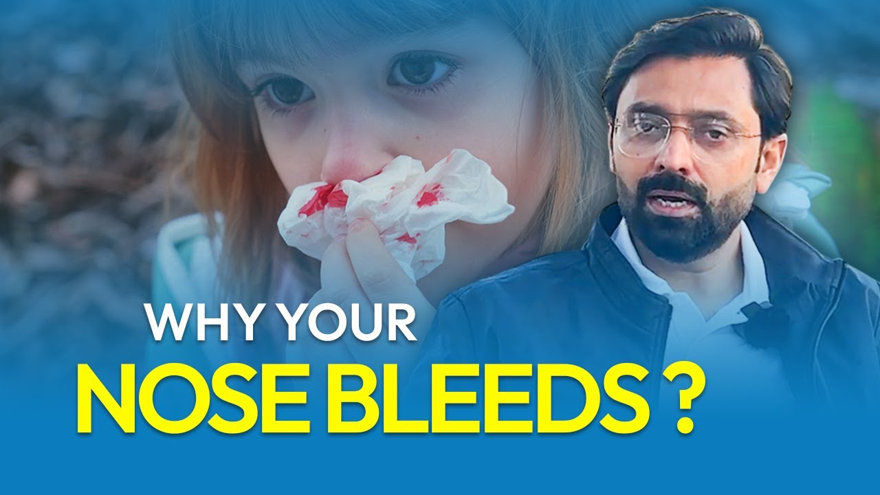 Frequent Nosebleeds? ENT Surgeon Reveals Causes in Kids & Adults + How to Manage