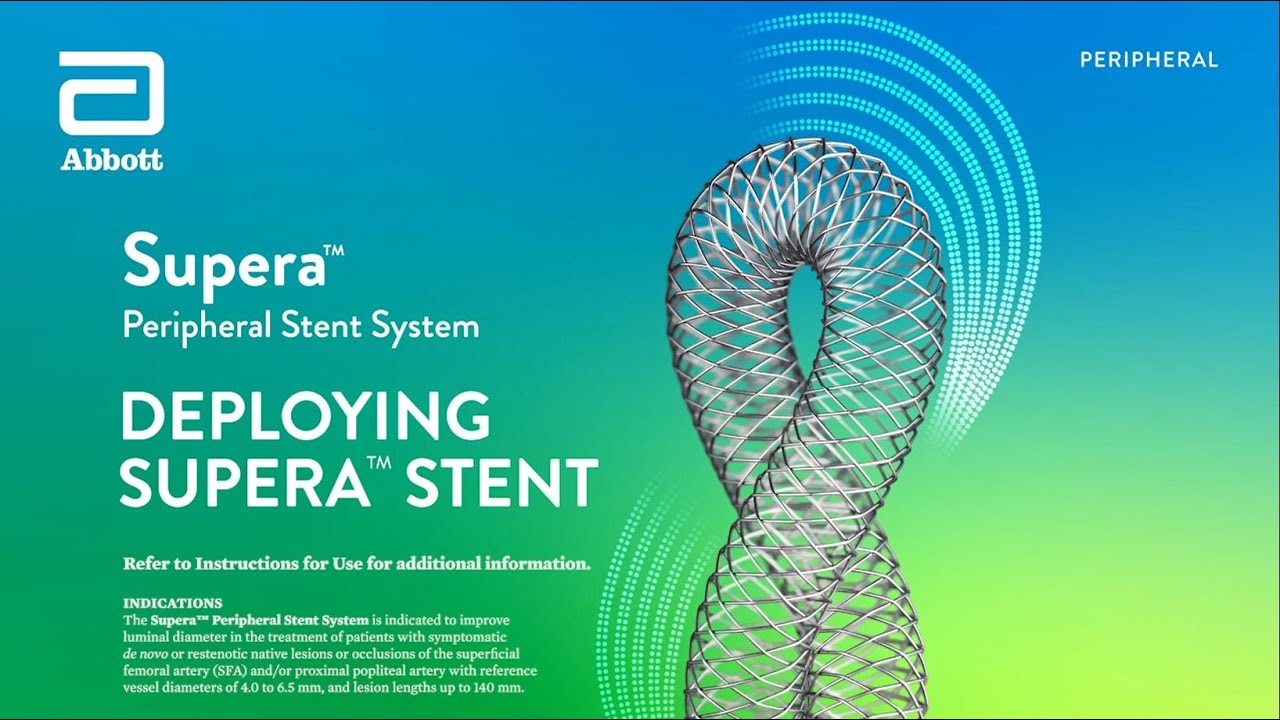 How to Deploy the Supera Stent | Supera Stent System Overview