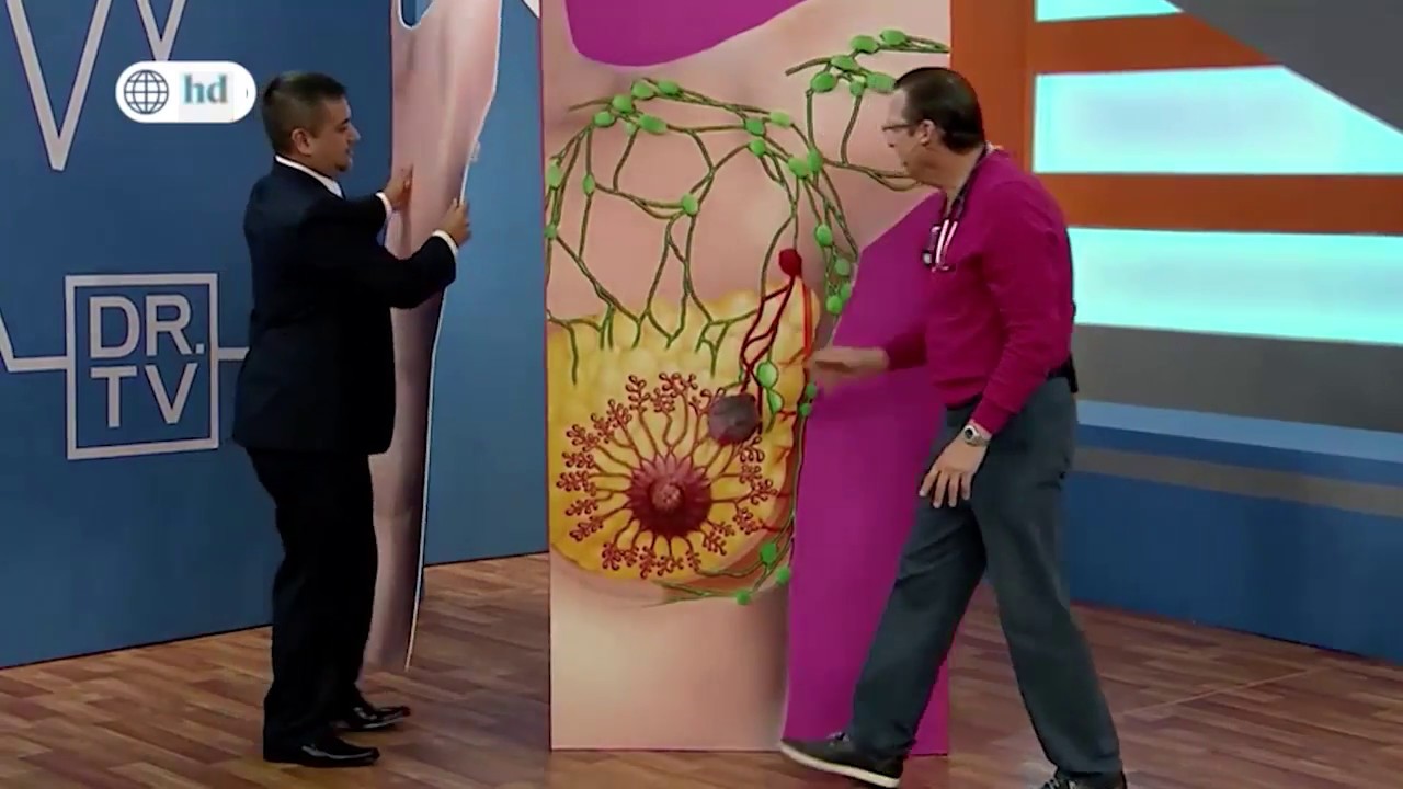 Cáncer de mama - Síntomas y causas