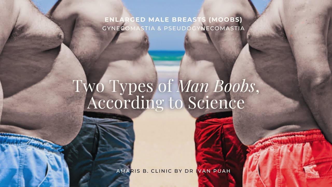 Two Types of Man Boobs, According to Science