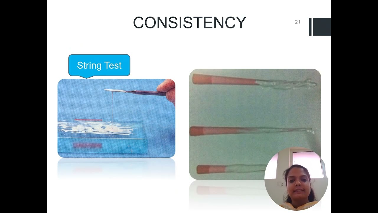Root canal sealers  GP and diagnostic techniques vedio