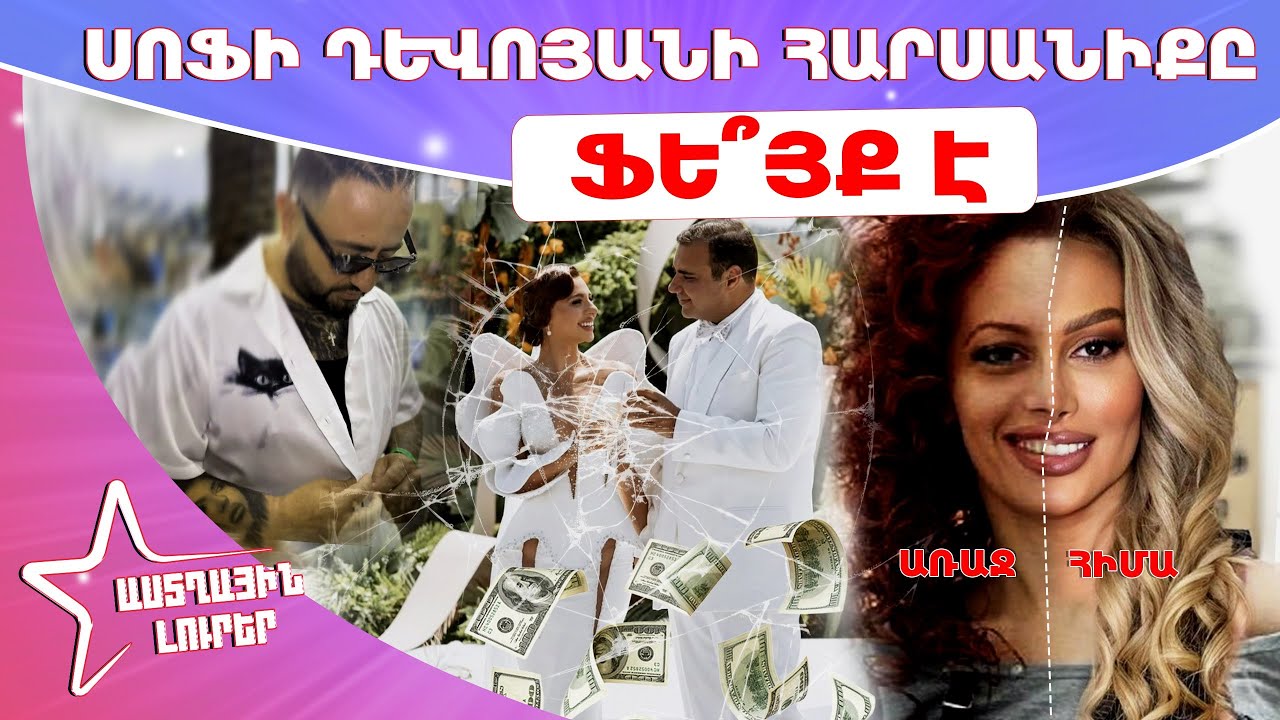 Նոր մանրամասներ հարսանիքից․ Լուիզա Ներսիսյանի վիրահատություններն ու Սուպեր Սաքոյի նոր դաջվածքը