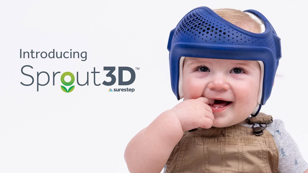 Introducing the Surestep Sprout3D™ Cranial Remolding Orthosis