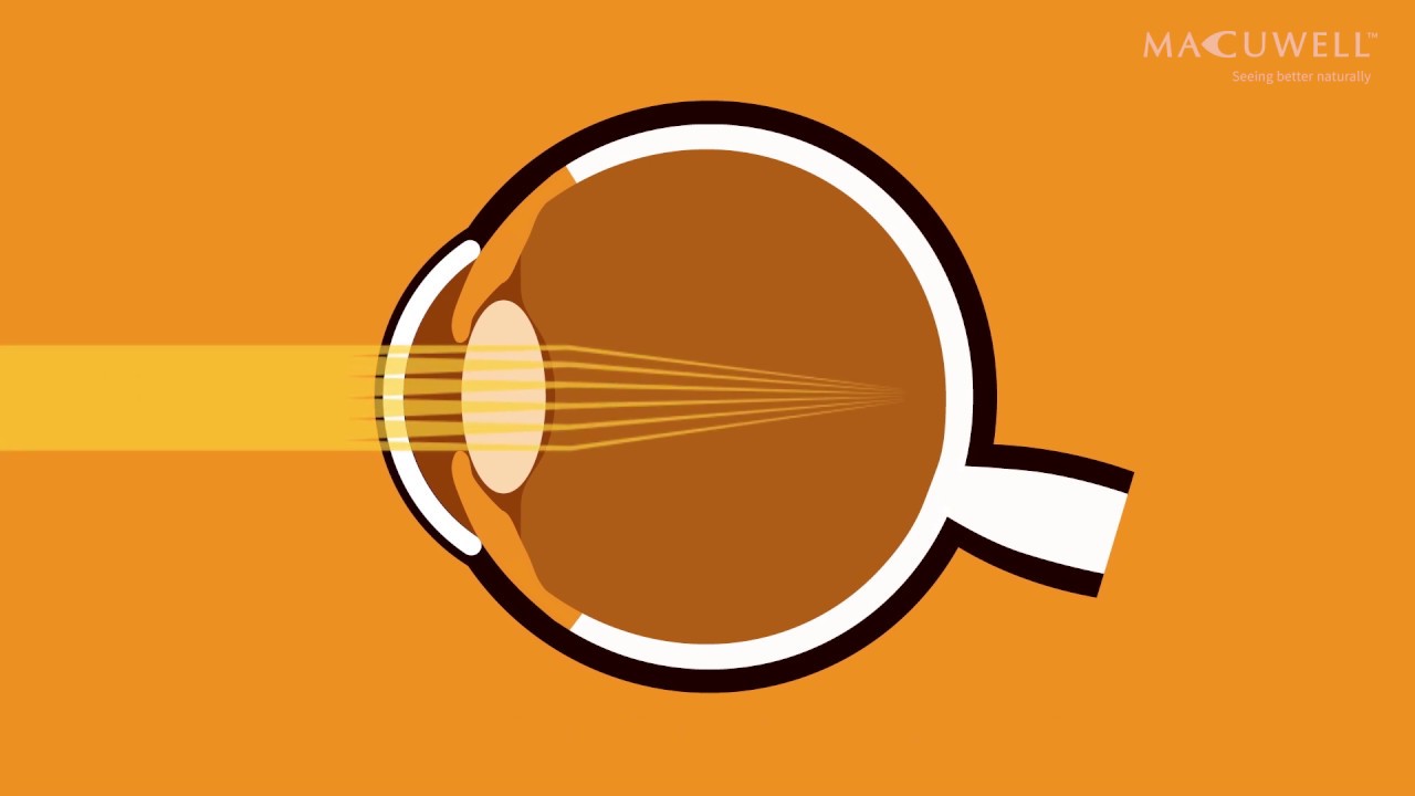 What is macular pigment? How does macular pigment (the yellow spot) affect your eye health?