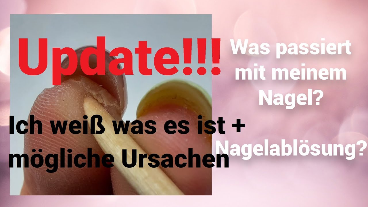 Update!!! Was passiert mit meinem Nagel? Nagelablösung?| Mimi made it