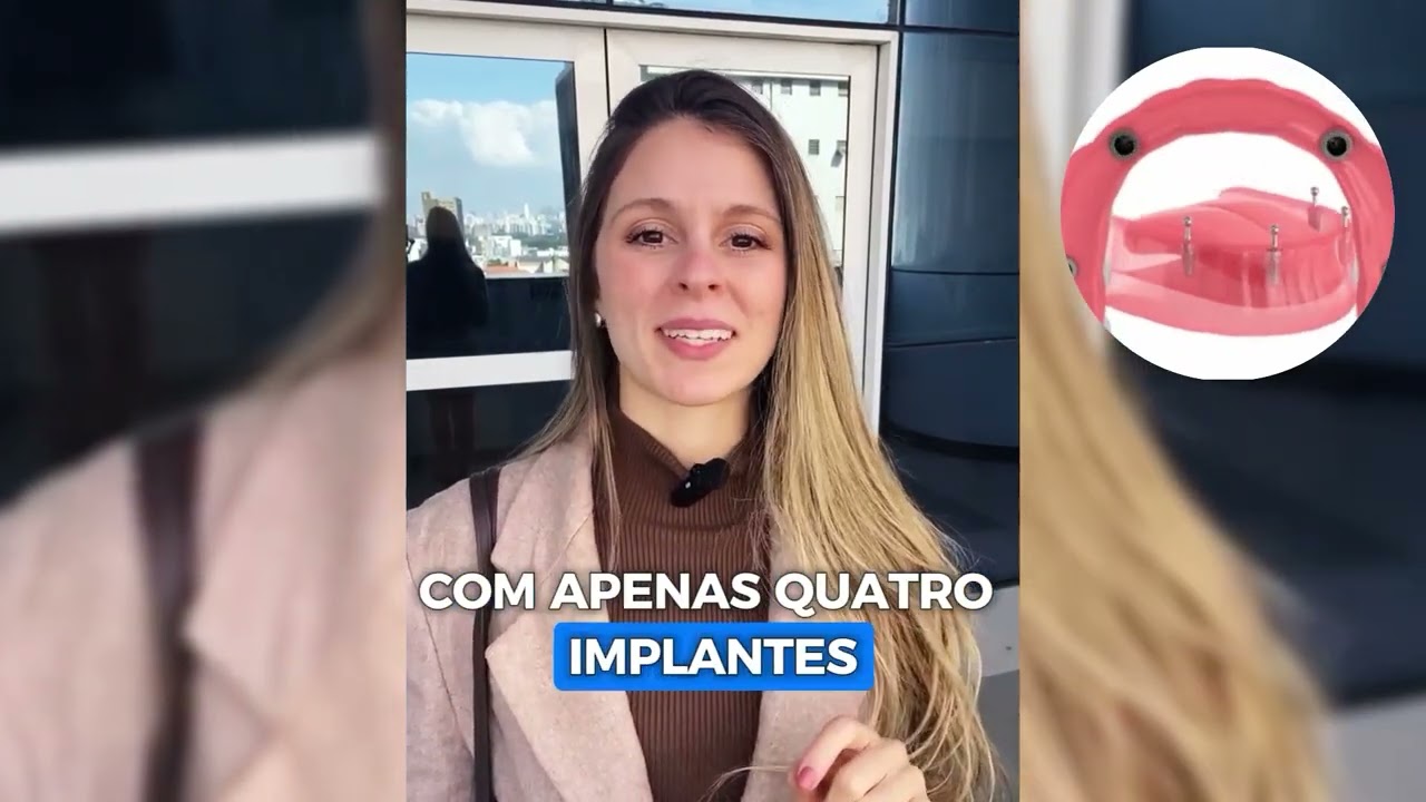 Devolva o Sorriso e a Confian&ccedil;a com Implantes Dent&aacute;rios